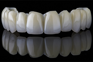 セラミック歯
